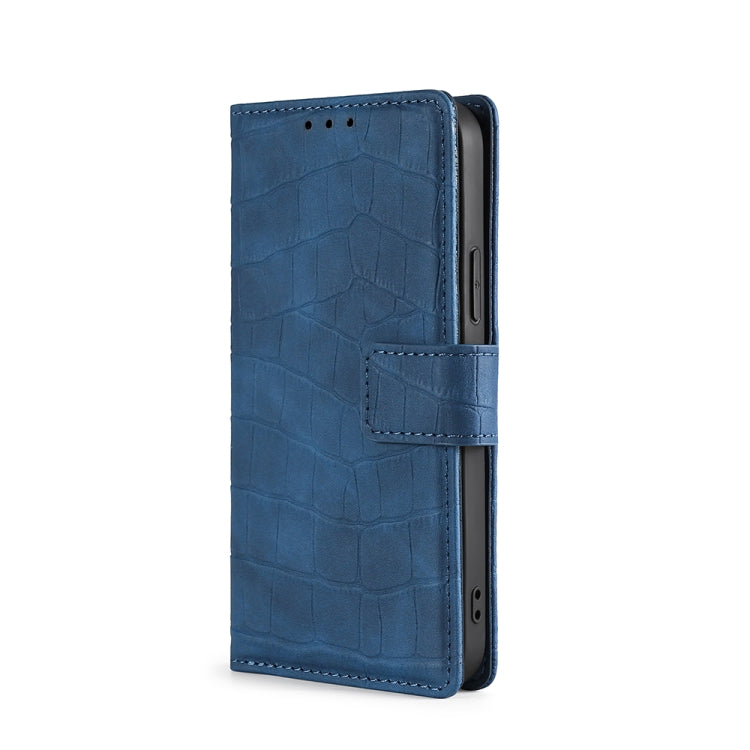 For Doogee X95 Skin Feel Crocodile Texture Magnetic Clasp Horizontal Flip PU Leather Case with Holder & Card Slots & Wallet(Blue) - More Brand by PMC Jewellery | Online Shopping South Africa | PMC Jewellery | Buy Now Pay Later Mobicred