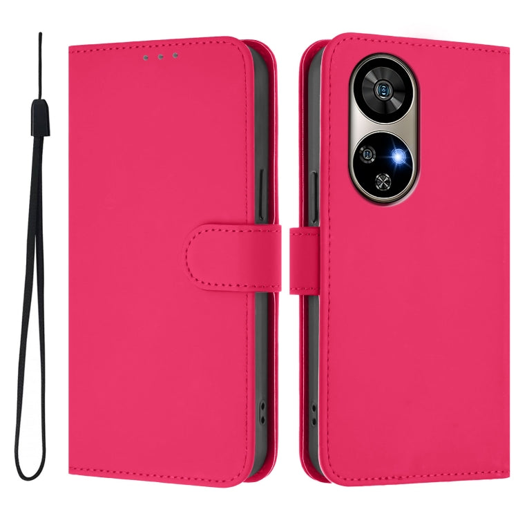 For Ulefone Note 17 Pro Skin Feel Solid Color Leather Phone Case with Lanyard(Rose Red) - Ulefone Cases by PMC Jewellery | Online Shopping South Africa | PMC Jewellery | Buy Now Pay Later Mobicred