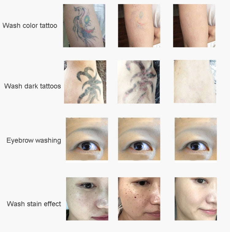 Laser Tattoo Removal Machine Non-invasive Eyebrow Washing Beauty Equipment(AU Plug) - free shipping - PMC TechLife - Order now!