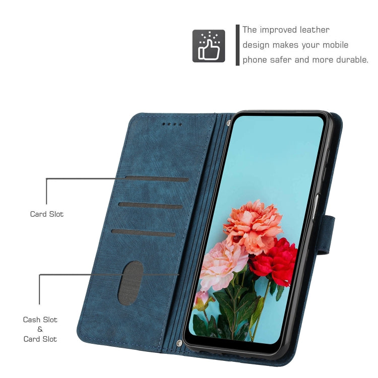 For OnePlus Nord CE 3/Nord CE 3 Lite/Nord N30 Skin Feel Stripe Pattern Leather Phone Case with Lanyard(Blue) - free shipping - PMC TechLife - Order now!