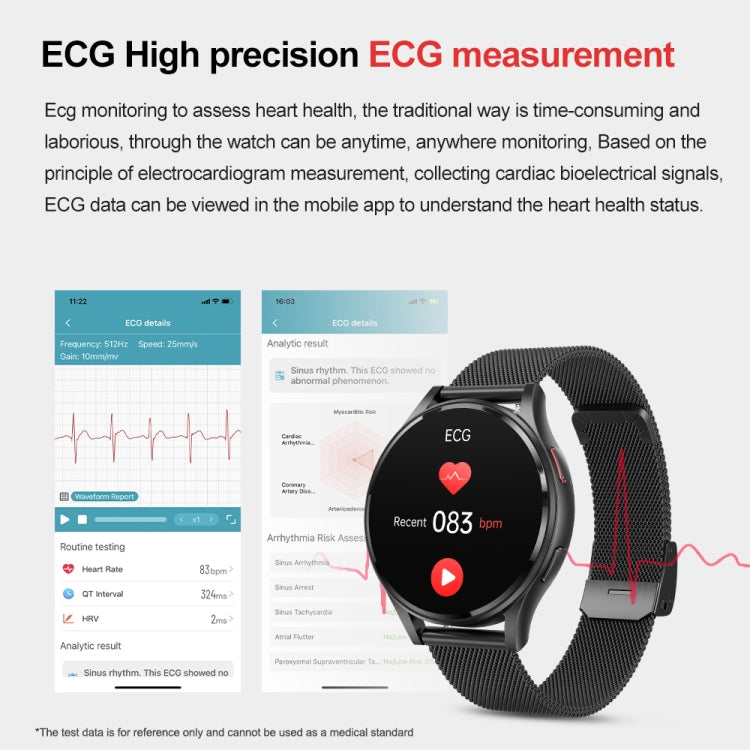 1.43 inch Silicone Strap Bluetooth Call Smart Watch Support ECG / Non-invasive Blood Sugar(Light Yellow) - free shipping - PMC TechLife - Order now!
