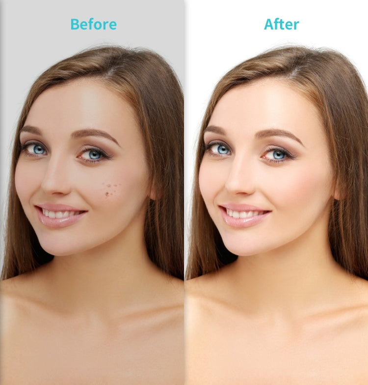 Xpreen XPRE061 Professional Dark Spot Remover Freckle Tattoo Chargeable Wart Mole Remover, with LED Screen and Spotlight(Tarnish) - Beauty Instrument by Xpreen | Online Shopping South Africa | PMC TechLife | Buy Now Pay Later Mobicred