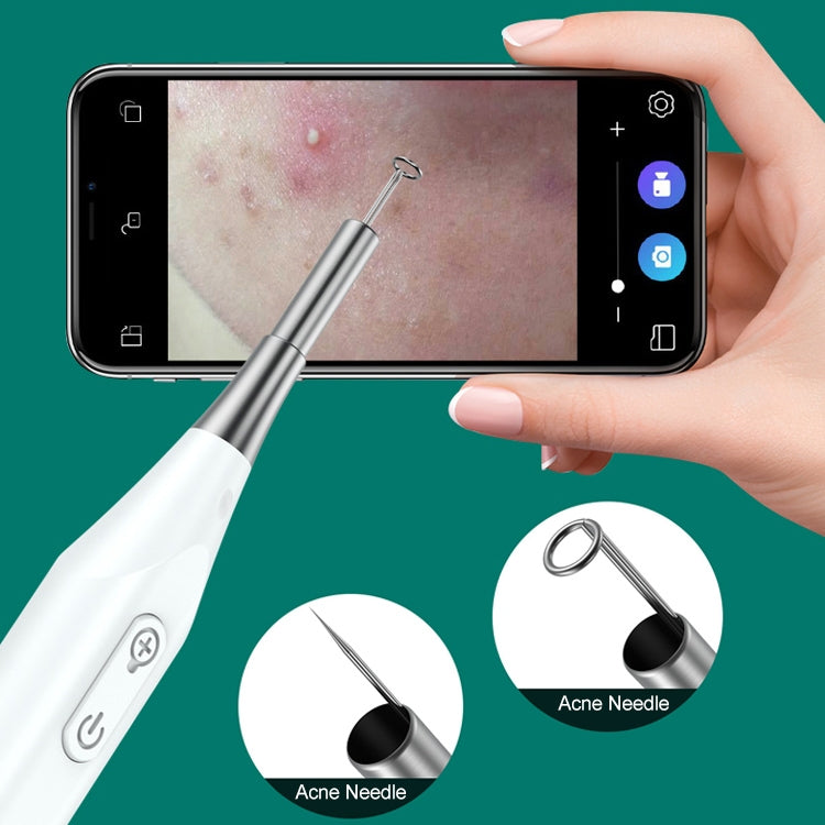 Supereyes Y009 Visual Ear Pick Acne Cleaning Microscopic Magnifying Mirror Endoscope - Ear Care Tools by Supereyes | Online Shopping South Africa | PMC Jewellery