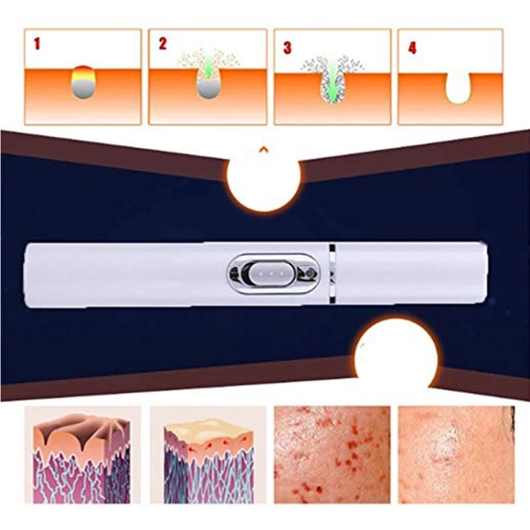 K-SKIN KD-7910 Acne Laser Pen Portable Wrinkle Removal Machine Durable Soft Scar Remover Device Blue Light Therapy Pen - free shipping - PMC TechLife - Order now!