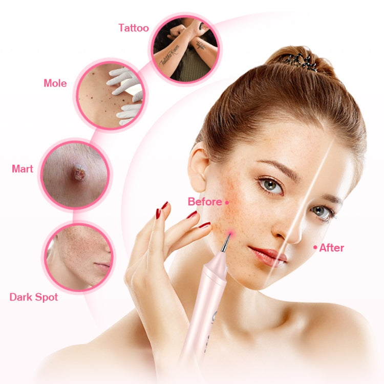 K-SKIN KD306 Laser Spotting Machine Plasma Pen Dark Eyelash Remover for Facial Spasm Removal Tattoo Skin Care(Pink) - free shipping - PMC TechLife - Order now!
