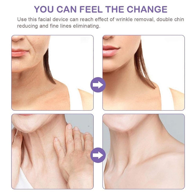 Electric Dolphin Neck Massager Wrinkle Removal Handheld Vibration Neck Face Massage Beauty Instrument Tool(Pearl White) - free shipping - PMC TechLife - Order now!