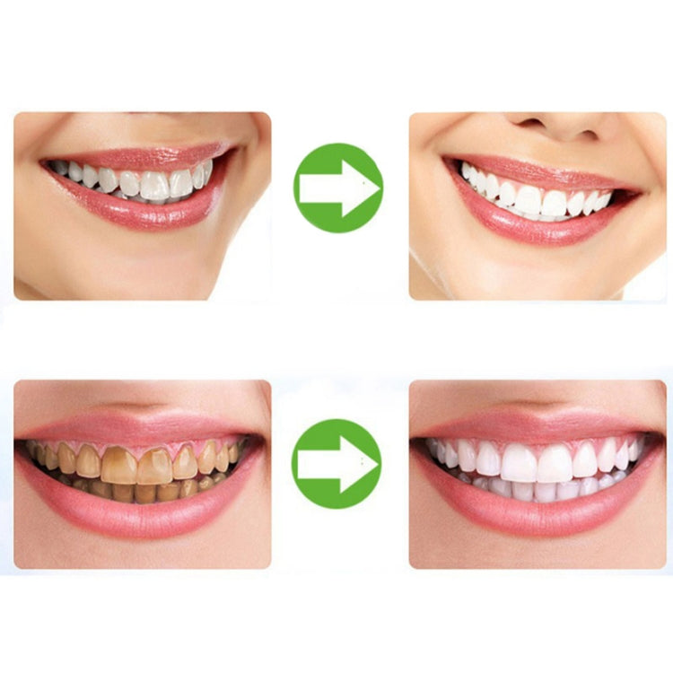 2 PCS Thermoforming Dental Mouthguard Teeth Whitening Trays Oral Care - Teeth Whitening by PMC TechLife | Online Shopping South Africa | PMC TechLife | Buy Now Pay Later Mobicred