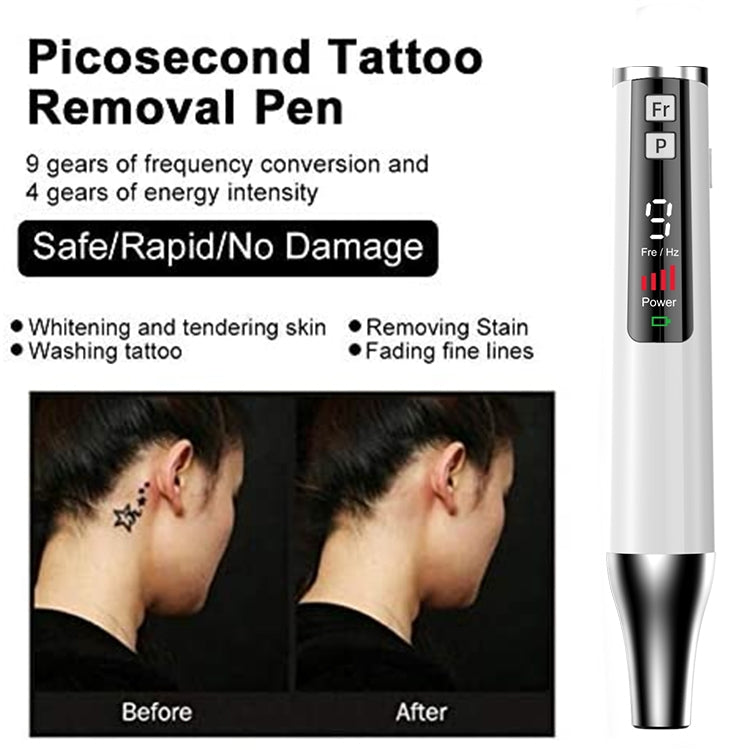 AA-A401 Small Freckle and Mole Removal Pen Tattoo and Eyebrow Removal Beauty Instrument, Color: Blu-ray Battery - Clothing & Beauty by PMC TechLife | Online Shopping South Africa | PMC TechLife